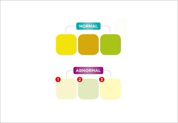 9 stool color chart samples examples templates sample templates