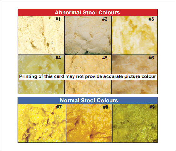 Stool Sample Color Chart