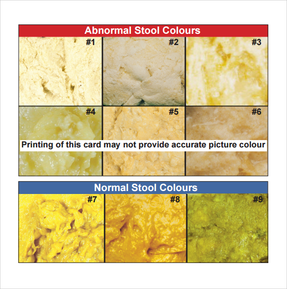 Sample Stool Color Chart Template 