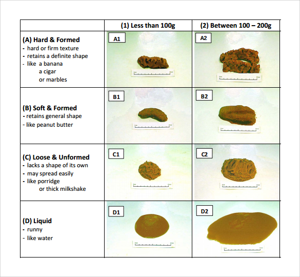 Stool Color Chart – 8+ Free Samples, Examples, Format