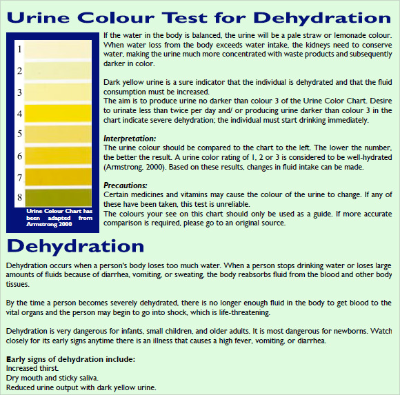 Urine Sample Colour Chart