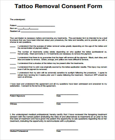 tattoo removal consent form example